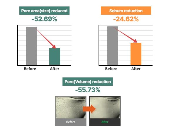 S.NATURE Aqua Squalane Cream packaging signals pore-care benefits