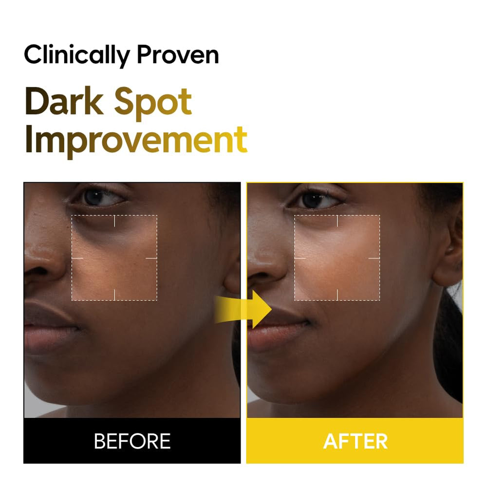 Saekdong Seoul toner ingredients-kojic-turmeric close-up highlights kojic acid and turmeric.