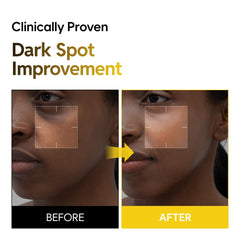 Saekdong Seoul toner ingredients-kojic-turmeric close-up highlights kojic acid and turmeric.