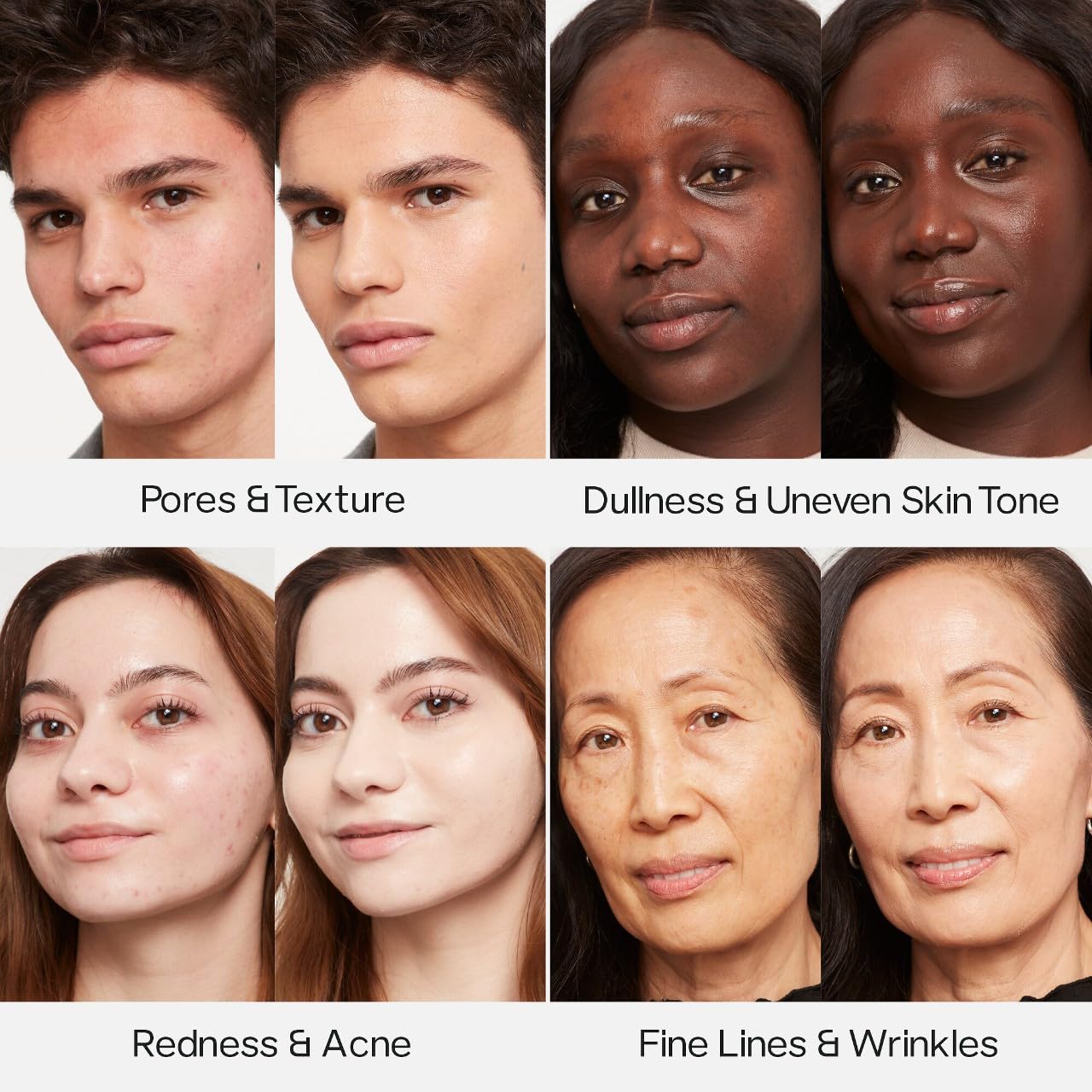 Saie bottle beside ingredient icons highlighting hyaluronic acid and skin benefits