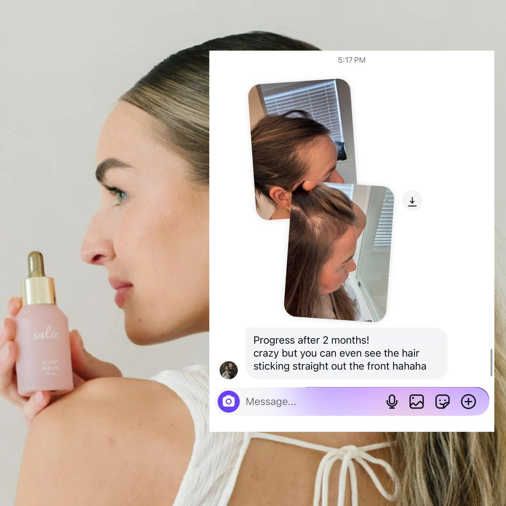 SALEE dry scalp serum application on hand demonstrating easy scalp use