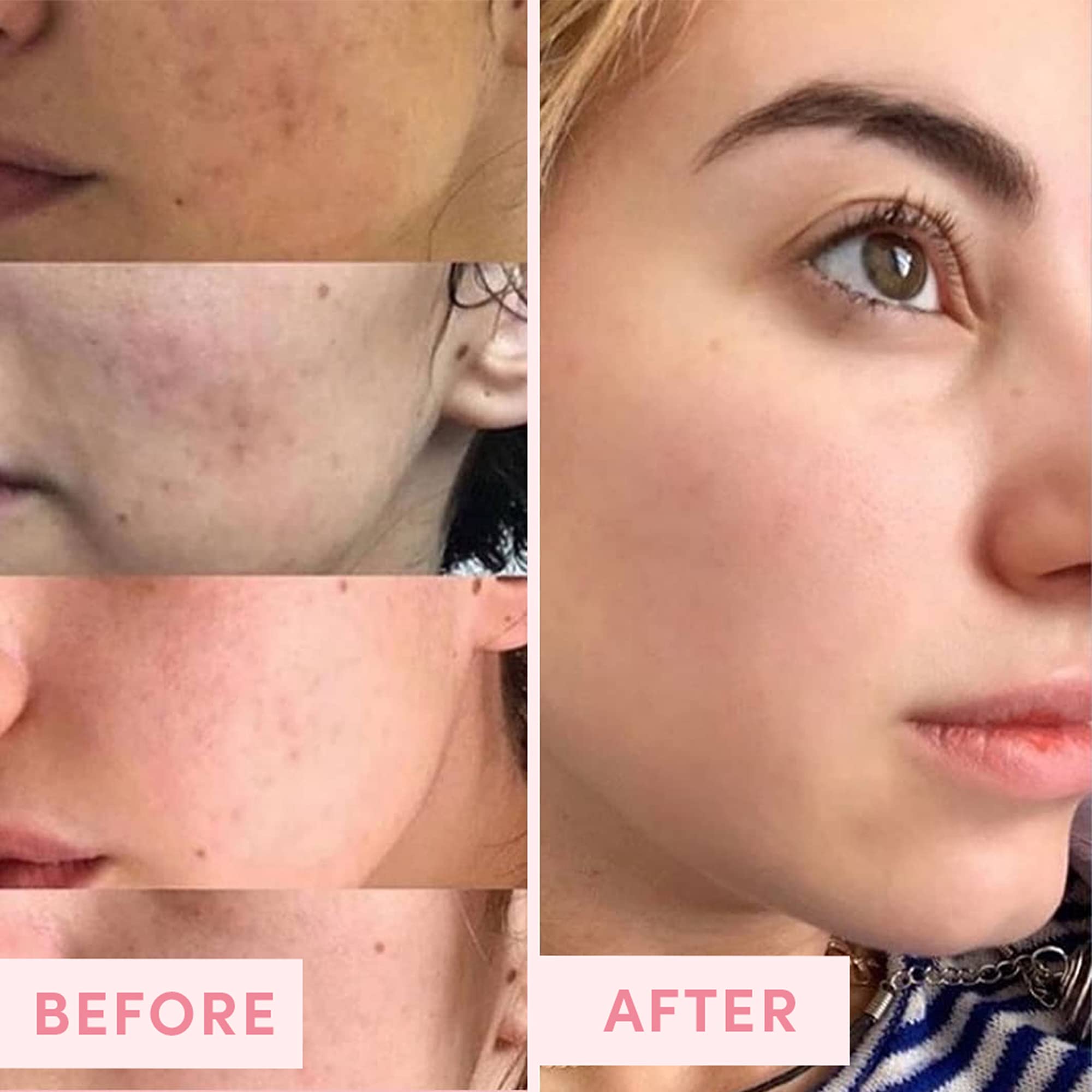 Sand & Sky daily skincare routine concept featuring mask as step integration