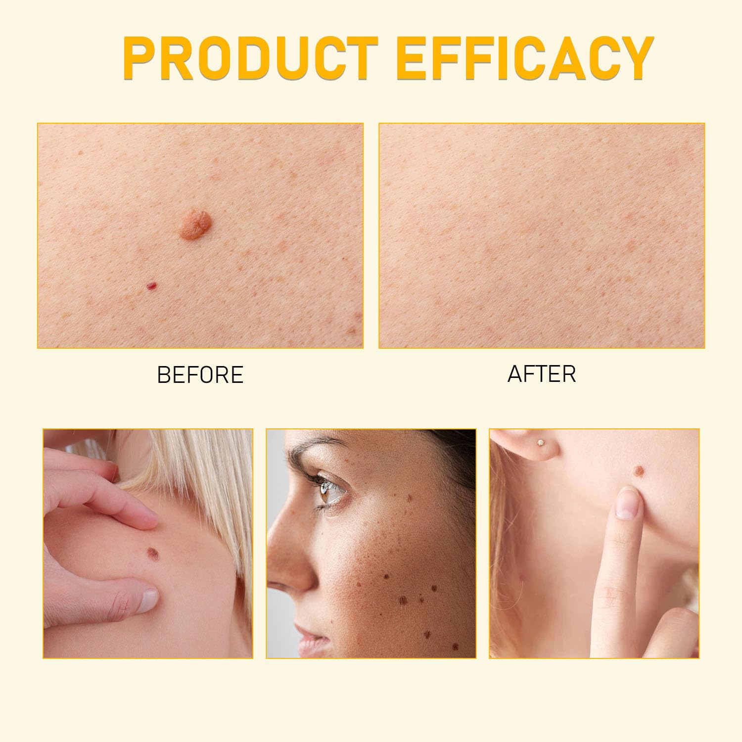 Satasiam Bee Venom Comprehensive Cream texture close-up hints at firming and elasticity support