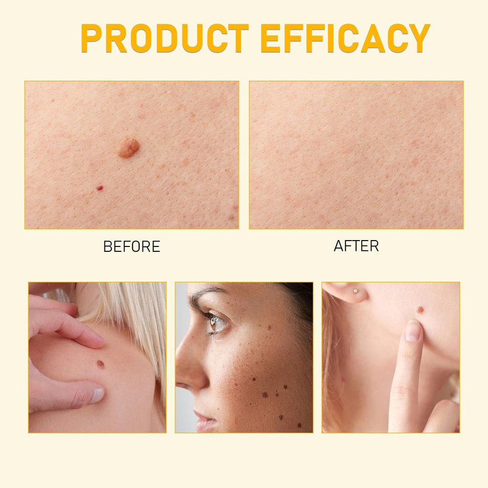Satasiam Bee Venom Comprehensive Cream texture close-up hints at firming and elasticity support