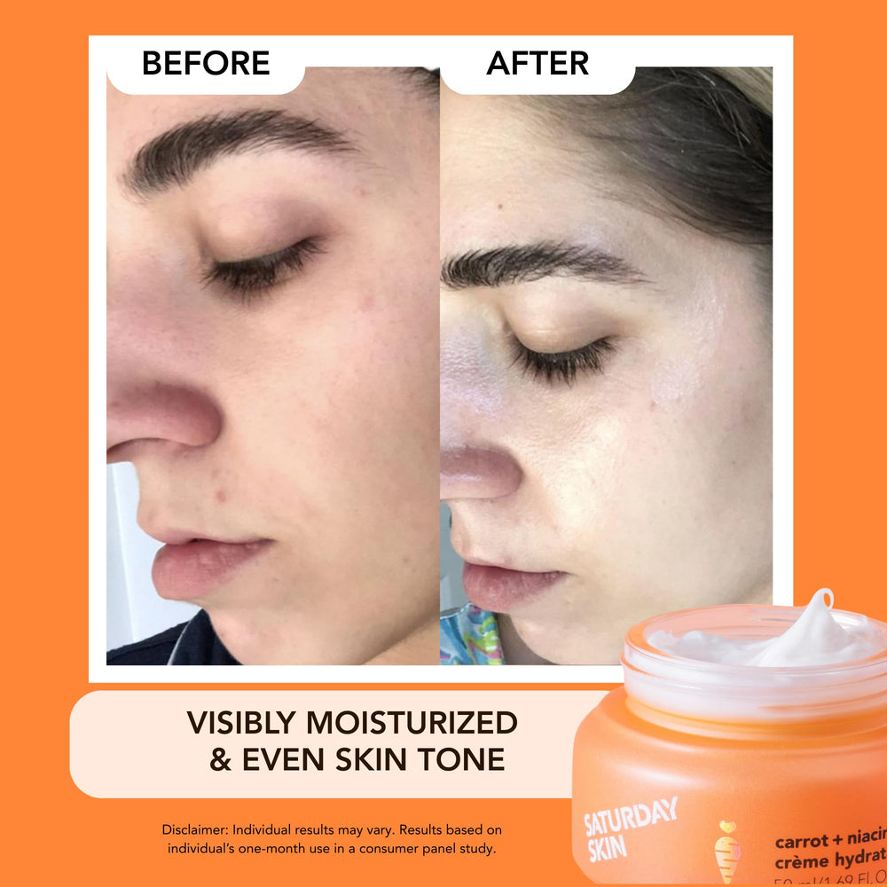 Saturday Skin fragrance-free moisturizer jar for sensitive skin comfort and hydration.