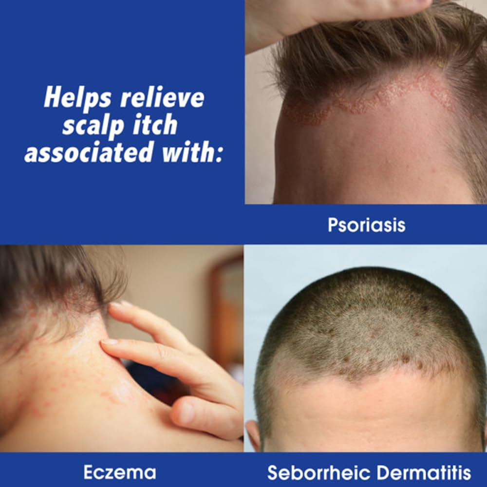 Scalpicin Max Strength fragrance-free-texture demonstrates greaseless formula on scalp