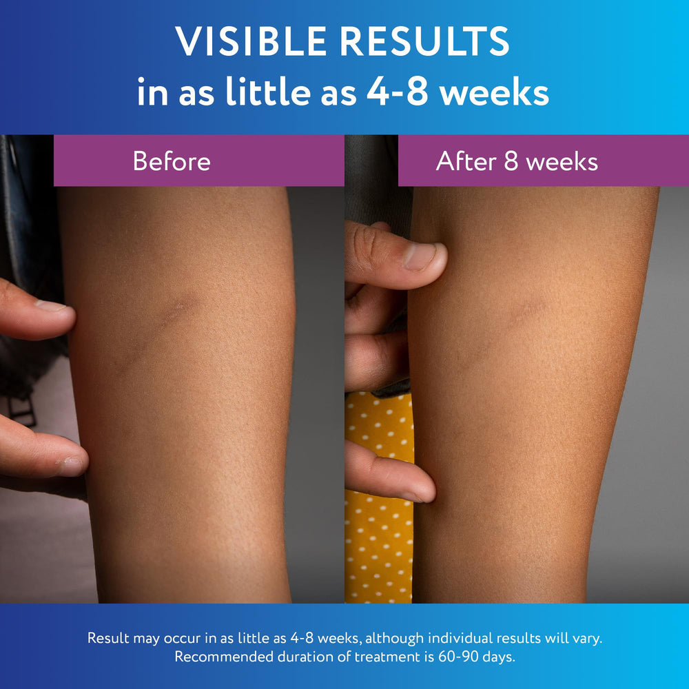 ScarAway application on arm showing targeted scar treatment benefit