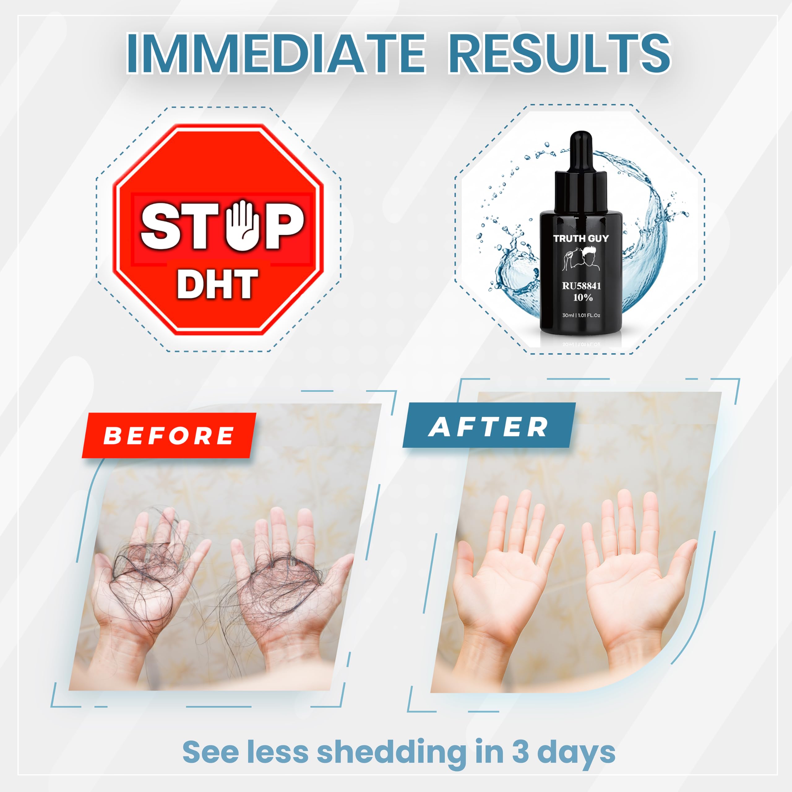 Truth Guy RU58841 product-focused shot highlights targeted scalp solution.