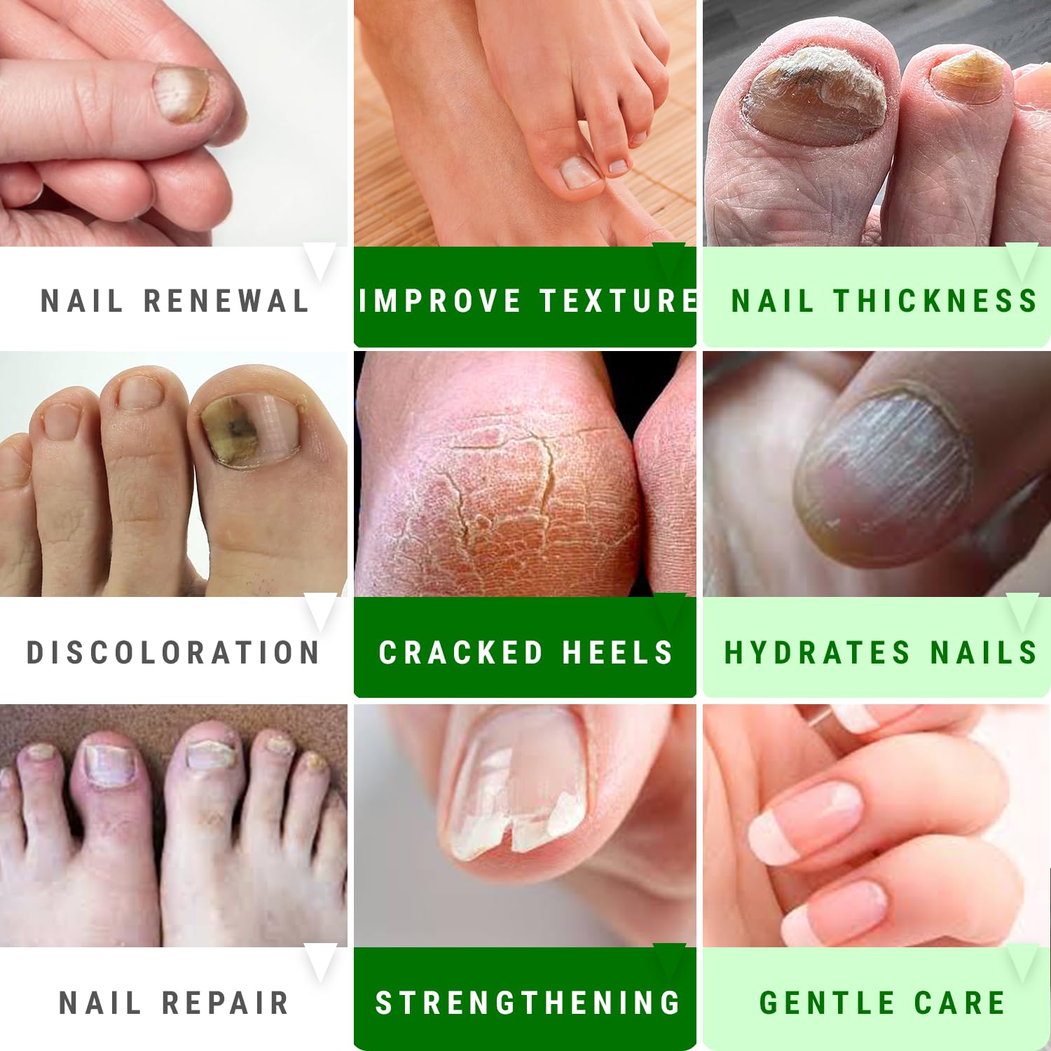 Scientific Solutions Global urea nail gel brightens yellowed nails for healthier look