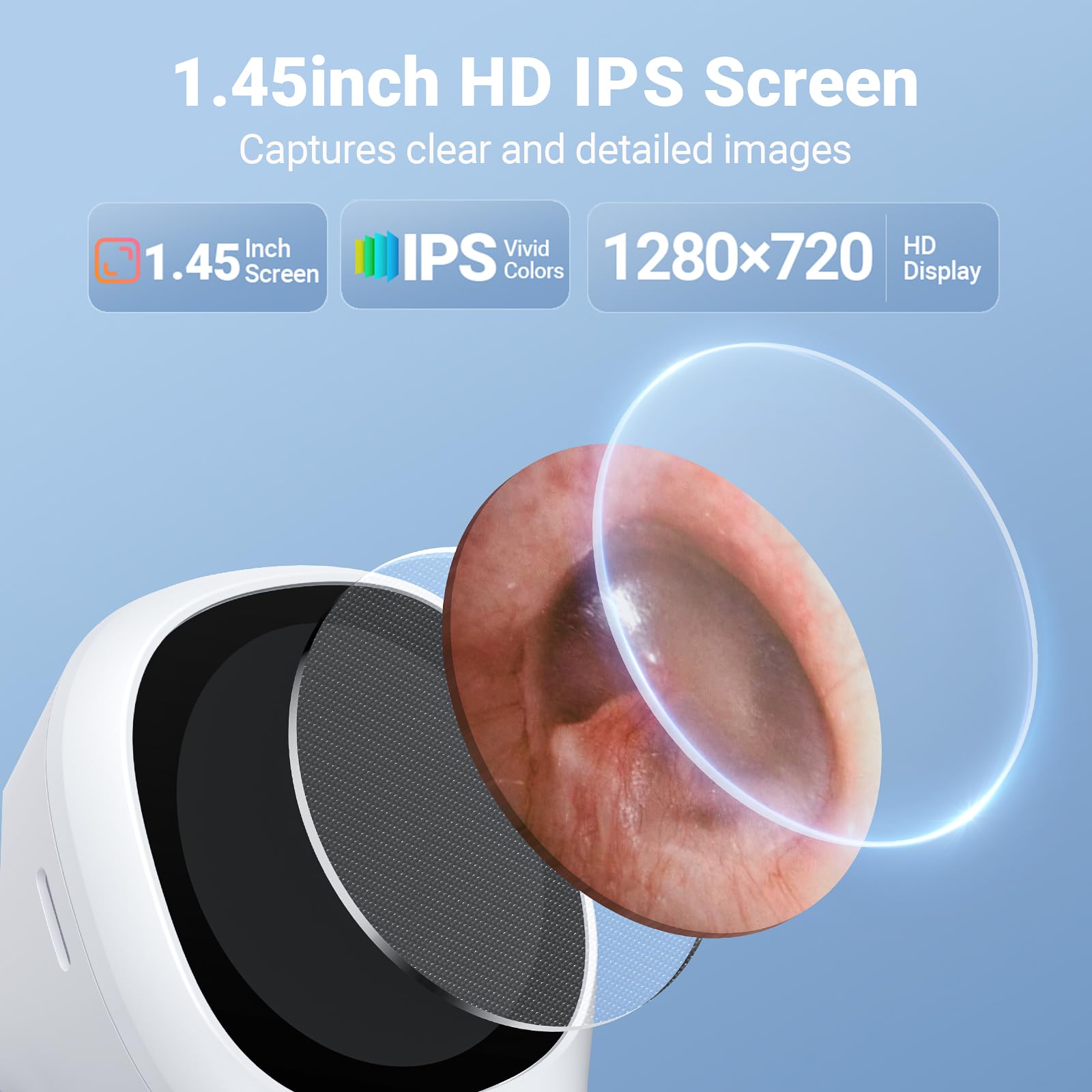 ScopeAround otoscope camera lens with 720P imaging for clear detail