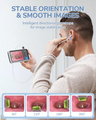 ScopeAround Otoscope gyroscope stabilizes images for steady viewing.