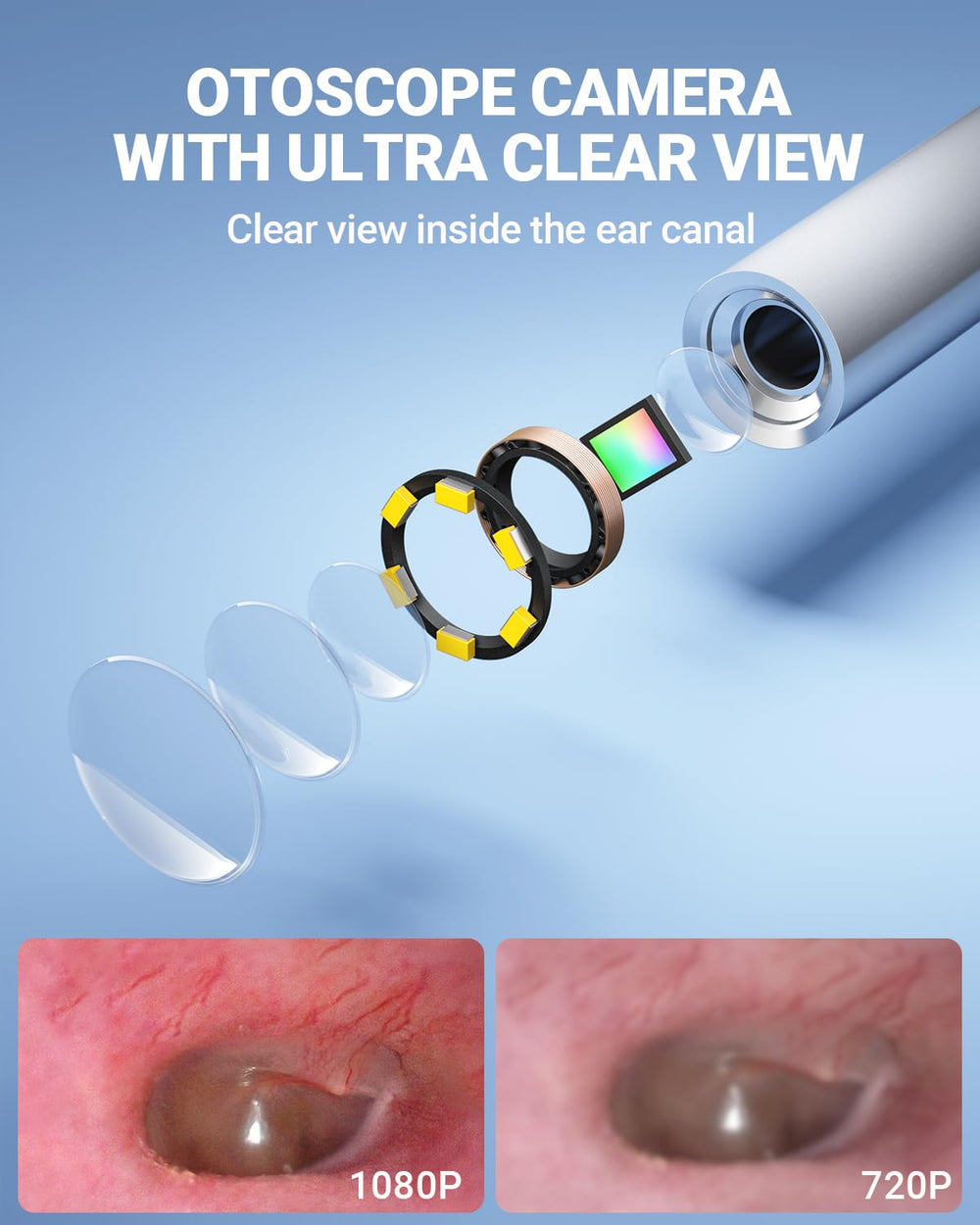 ScopeAround Otoscope shows adjustable LED lighting for precise viewing.