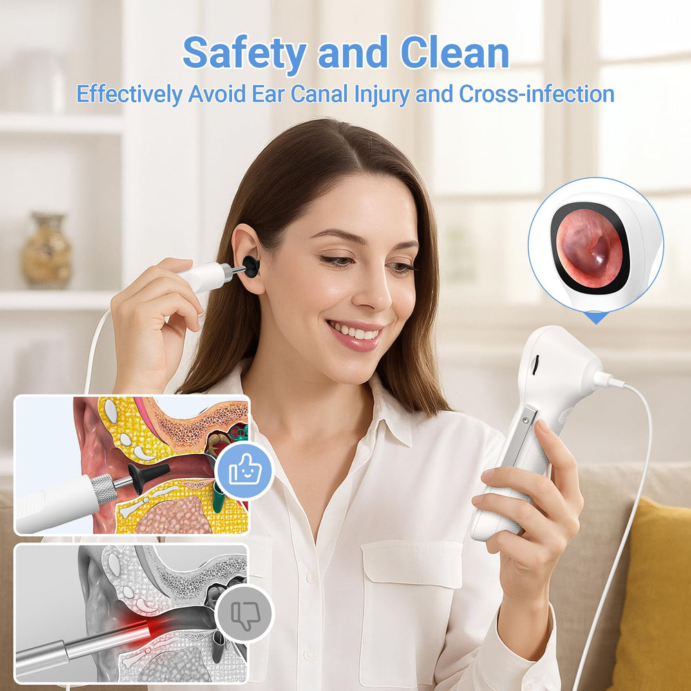 ScopeAround otoscope memory card stores photos and videos