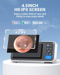 ScopeAround Otoscope silicone scoopers protect delicate ear canal.