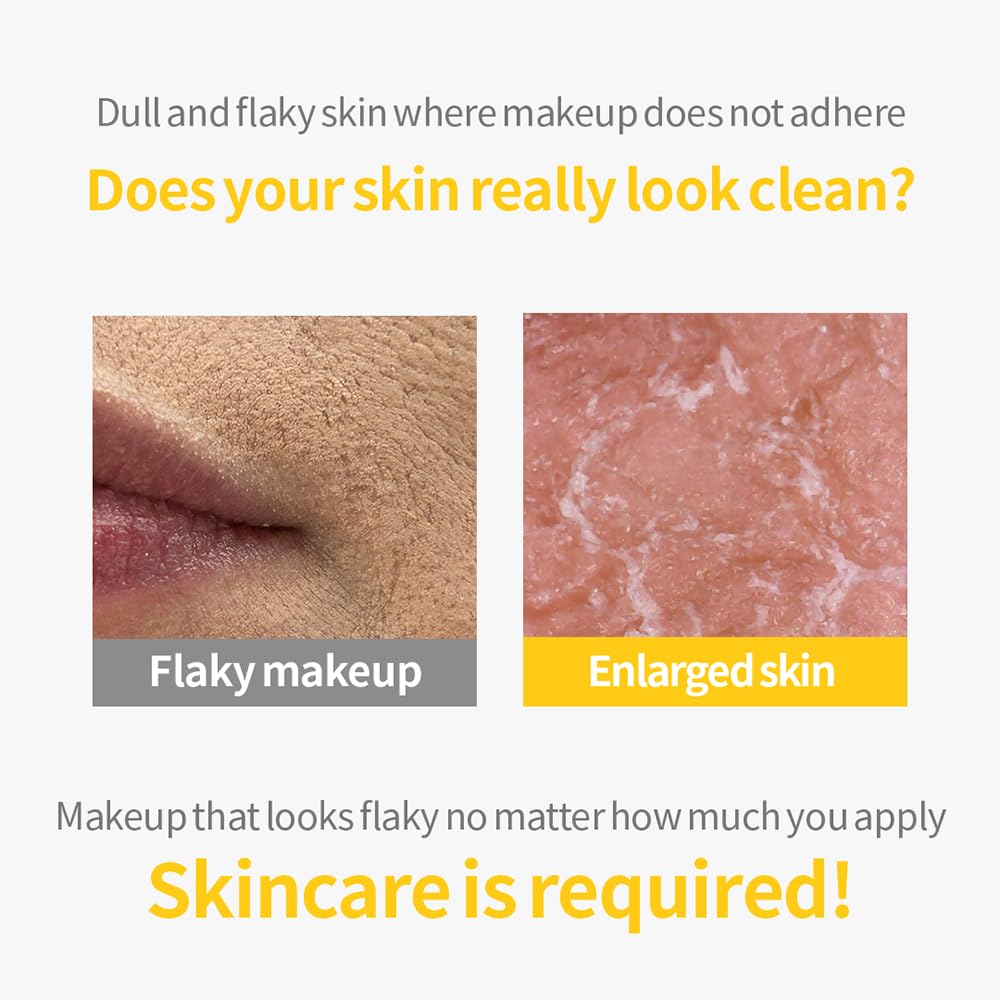 Secret Key Lemon Sparkling Peeling Gel cap, indicating gentle, low-irritation formula