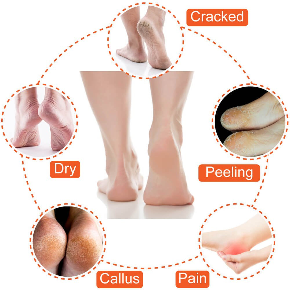 Selizo five-pair color pack view for versatile foot care.