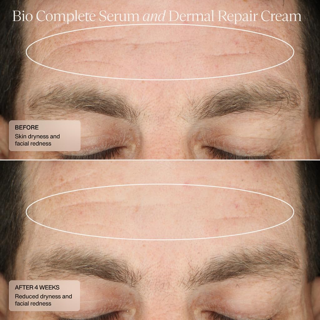 Sente Bio Complete Serum dermatologist-tested seal signals trusted formulation.