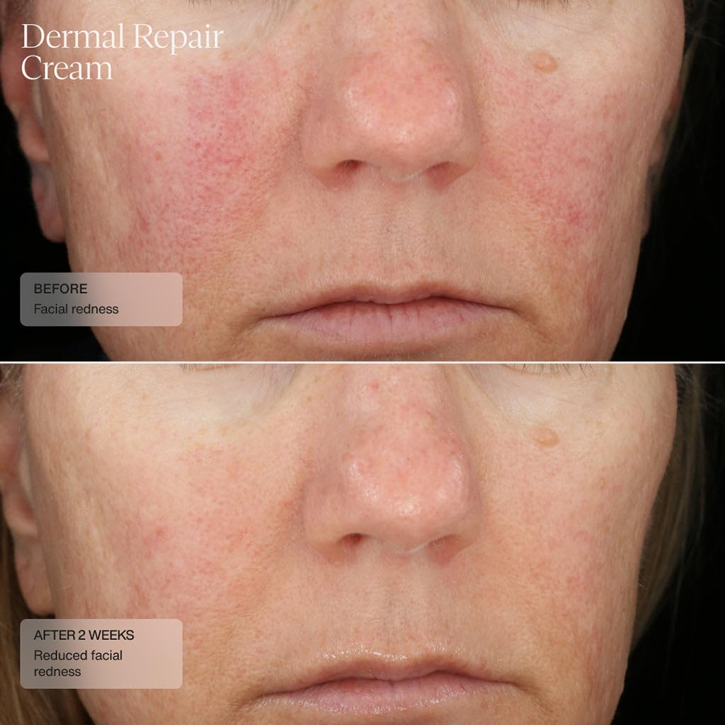 Senté Dermal Repair swirl reflects vitamin E and green tea goodness for soothing skin.