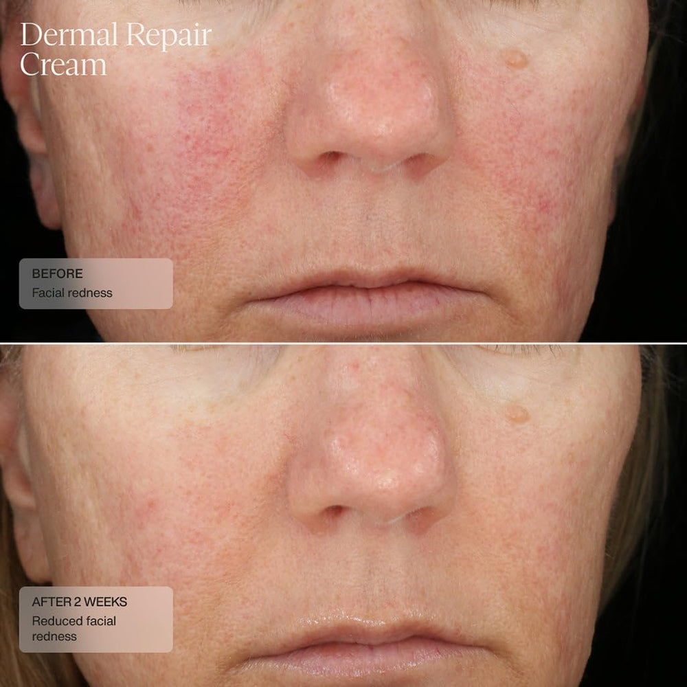 Senté Dermal Repair swirl reflects vitamin E and green tea goodness for soothing skin.