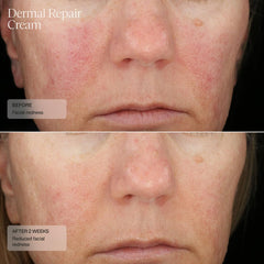 Senté Dermal Repair swirl reflects vitamin E and green tea goodness for soothing skin.