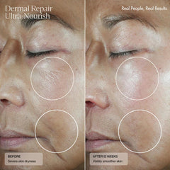 Senté Dermal Repair Ultra-Nourish tube close-up reveals a creamy, nourishing formula