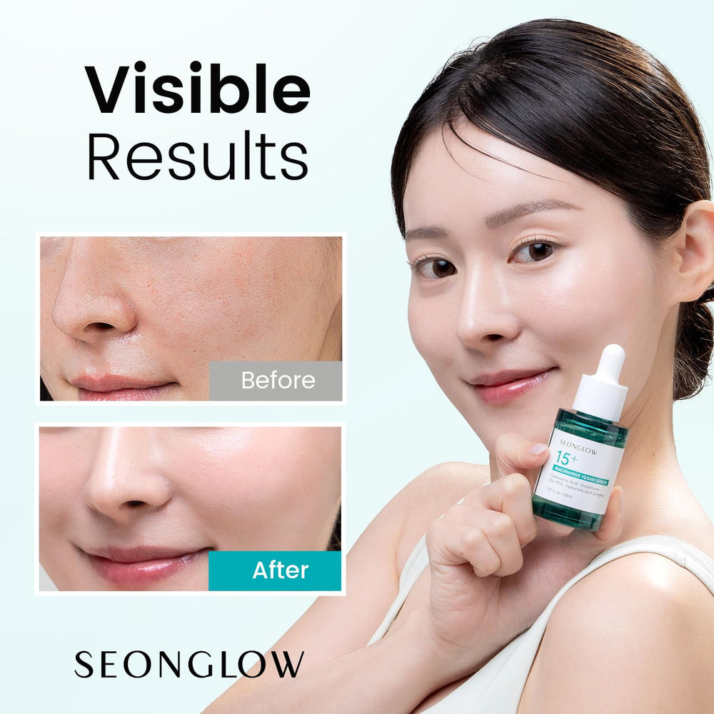 SEONGLOW Niacinamide serum packaging front highlighting premium formula and easy daily use.