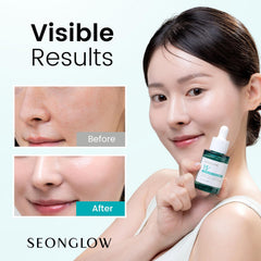 SEONGLOW Niacinamide serum packaging front highlighting premium formula and easy daily use.