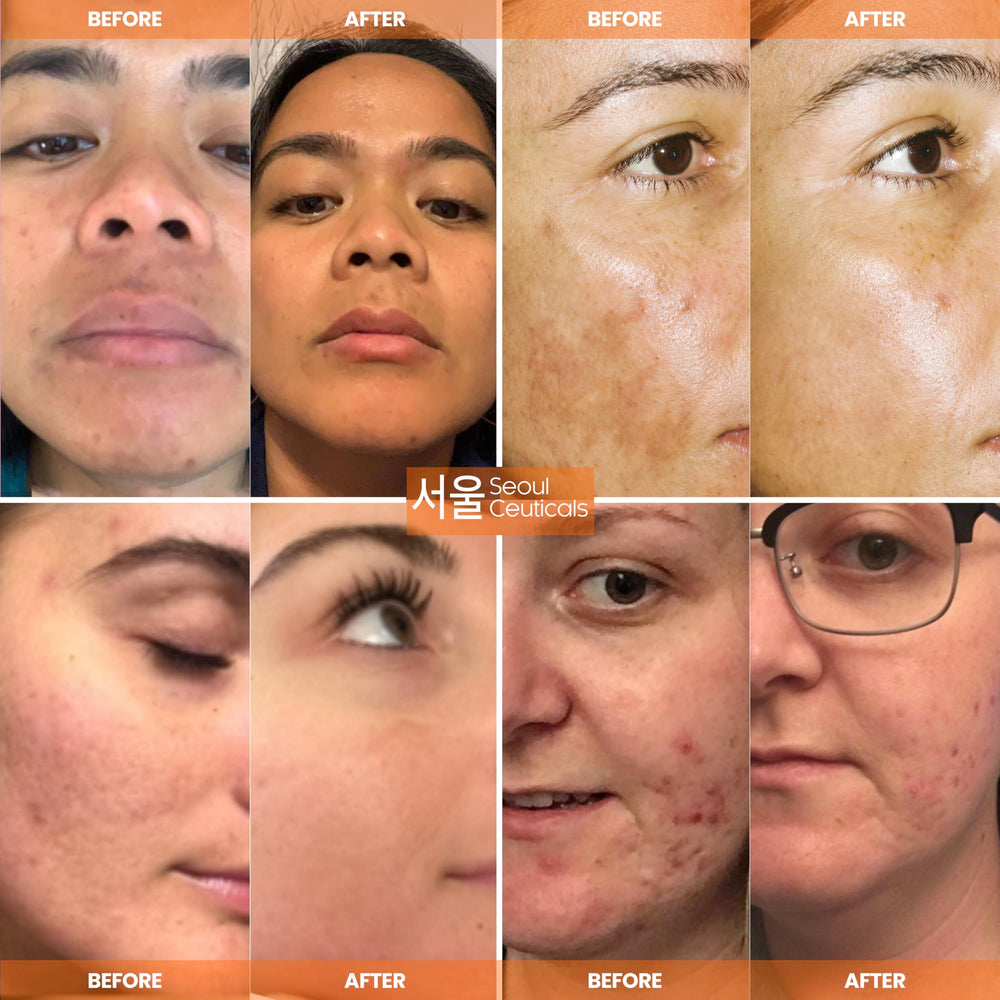 SeoulCeuticals serum dispense application shot demonstrates easy daily layering