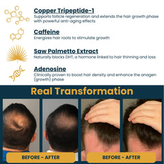 Seraphime Copper Peptide Serum applied to scalp during massage for density support.