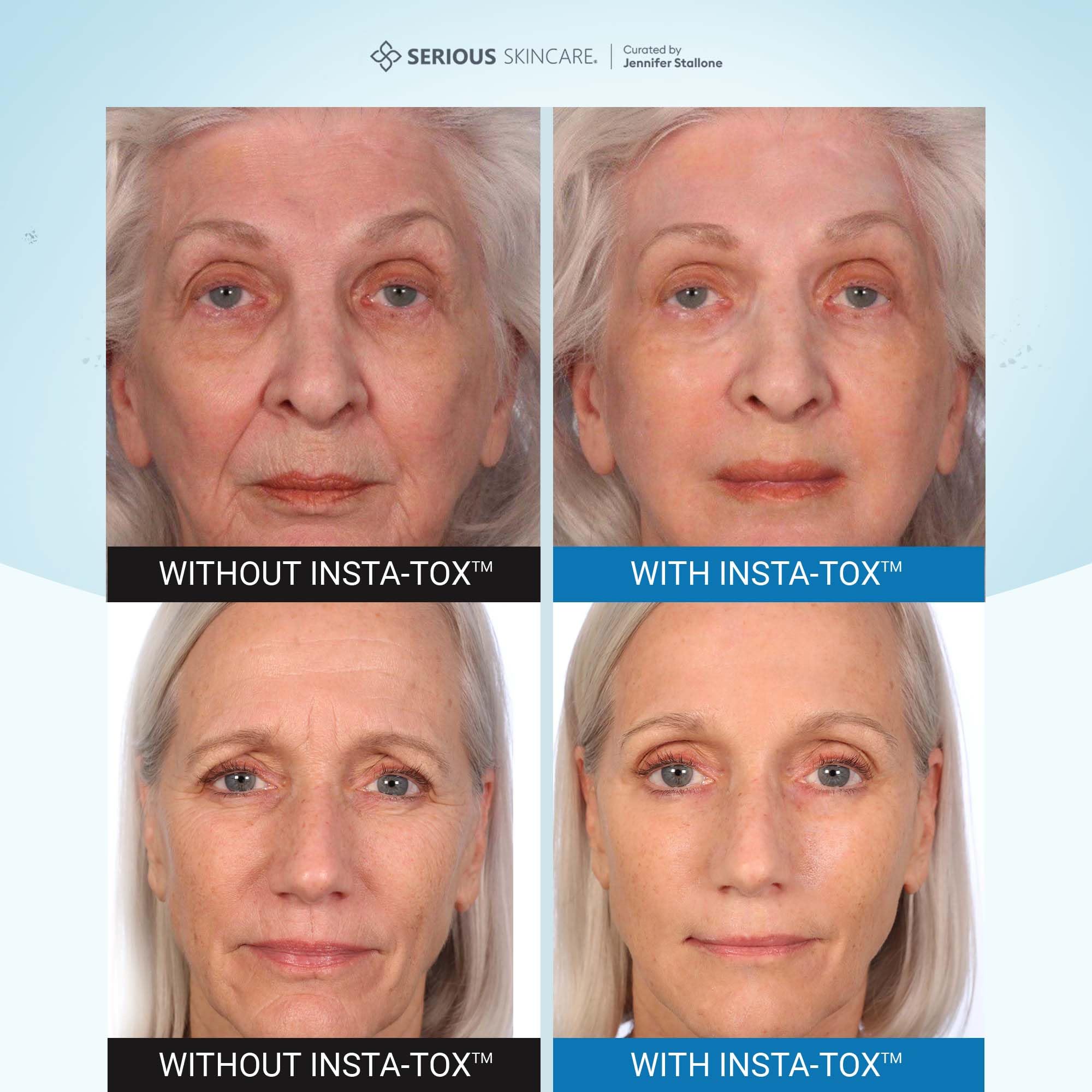 Serious Skincare INSTA-TOX facial tightening action being applied to cheek