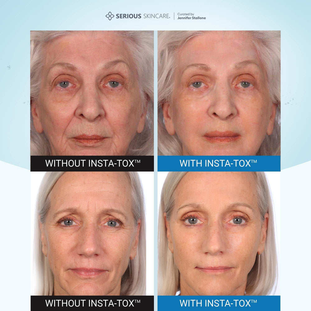 Serious Skincare INSTA-TOX facial tightening action being applied to cheek