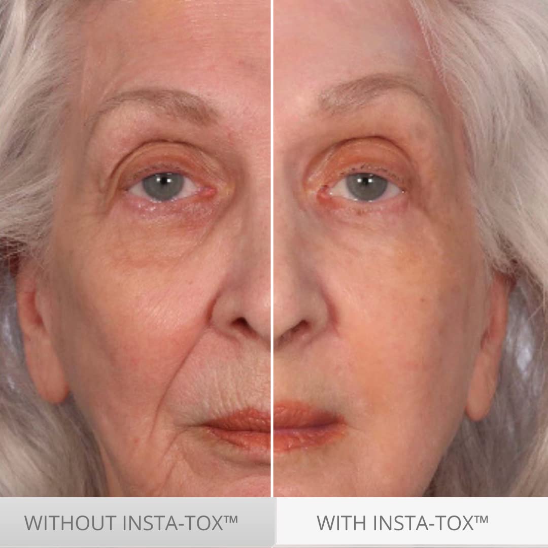 Serious Skincare INSTA-TOX on-face application hints at temporary tightening and smoothing.