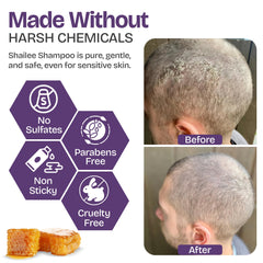 Shailee Psoriasis Shampoo foamy lather highlights gentle cleansing for itchy scalp