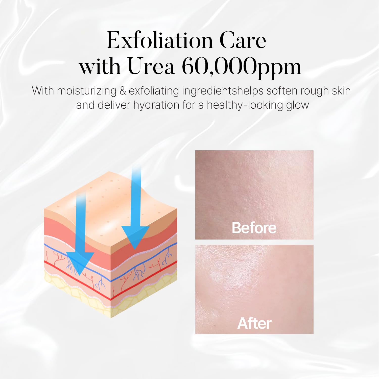 shaishaishai Liposome Repair Milky Cream features 60,000ppm Urea for soothing moisture