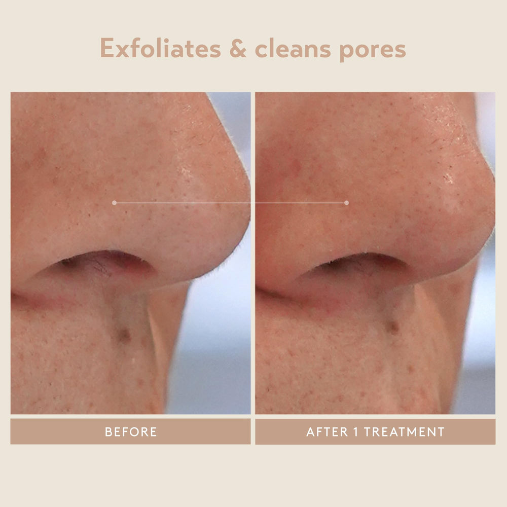 SHANI DARDEN ingredients label highlights mandelic, lactic, glycolic acids for exfoliation