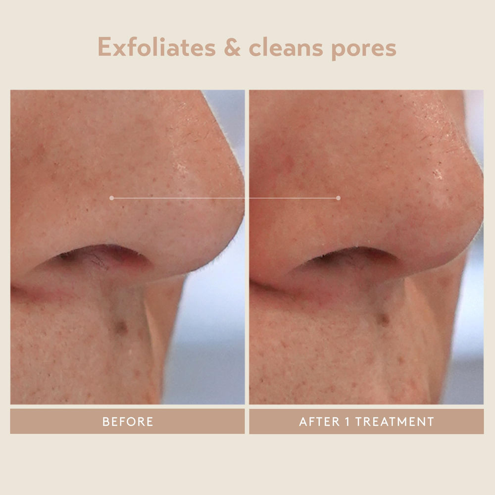 SHANI DARDEN Kaolin clay mask texture illustrating impurity drawing.