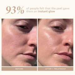 SHANI DARDEN Neutralizing mask close-up highlighting pore-clearing action.