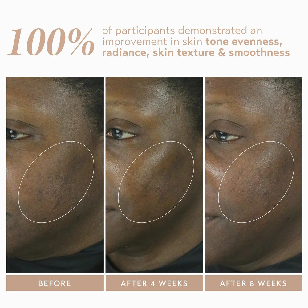 SHANI DARDEN Retinol Reform ingredients chart highlights niacinamide and ceramides for barrier support.