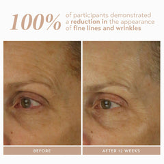 SHANI DARDEN Retinol Reform serum drop closeup highlighting gradual retinol release.