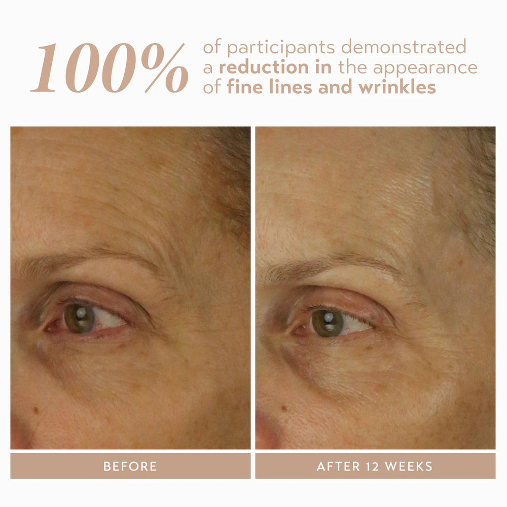 Shani Darden Retinol Reform serum pump dispense demonstrates controlled delivery for sensitive skin.
