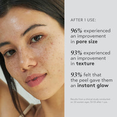 SHANI DARDEN Triple Acid Peel brush for precise, even application.