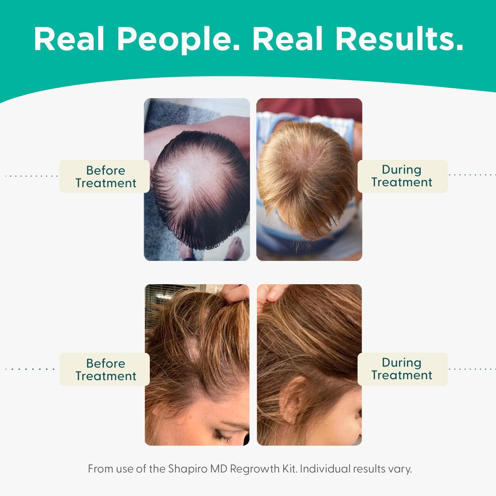 Shapiro MD dermatologist-developed logo emphasizes trusted, science-backed hair growth approach.