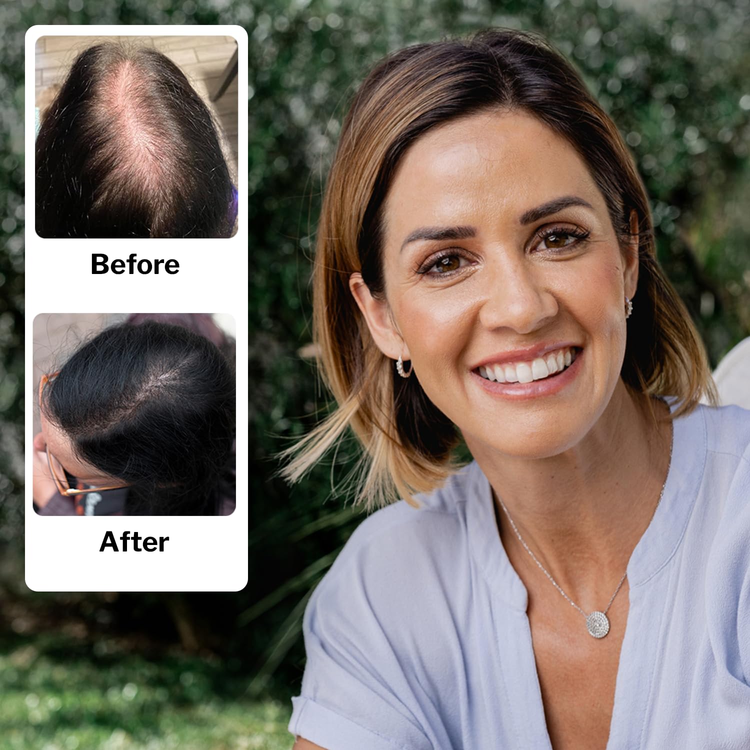 Shapiro MD regrowth kit box front image showcasing complete four-step regimen.