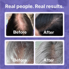 Shapiro MD leave-in foamer enables easy daily scalp distribution.