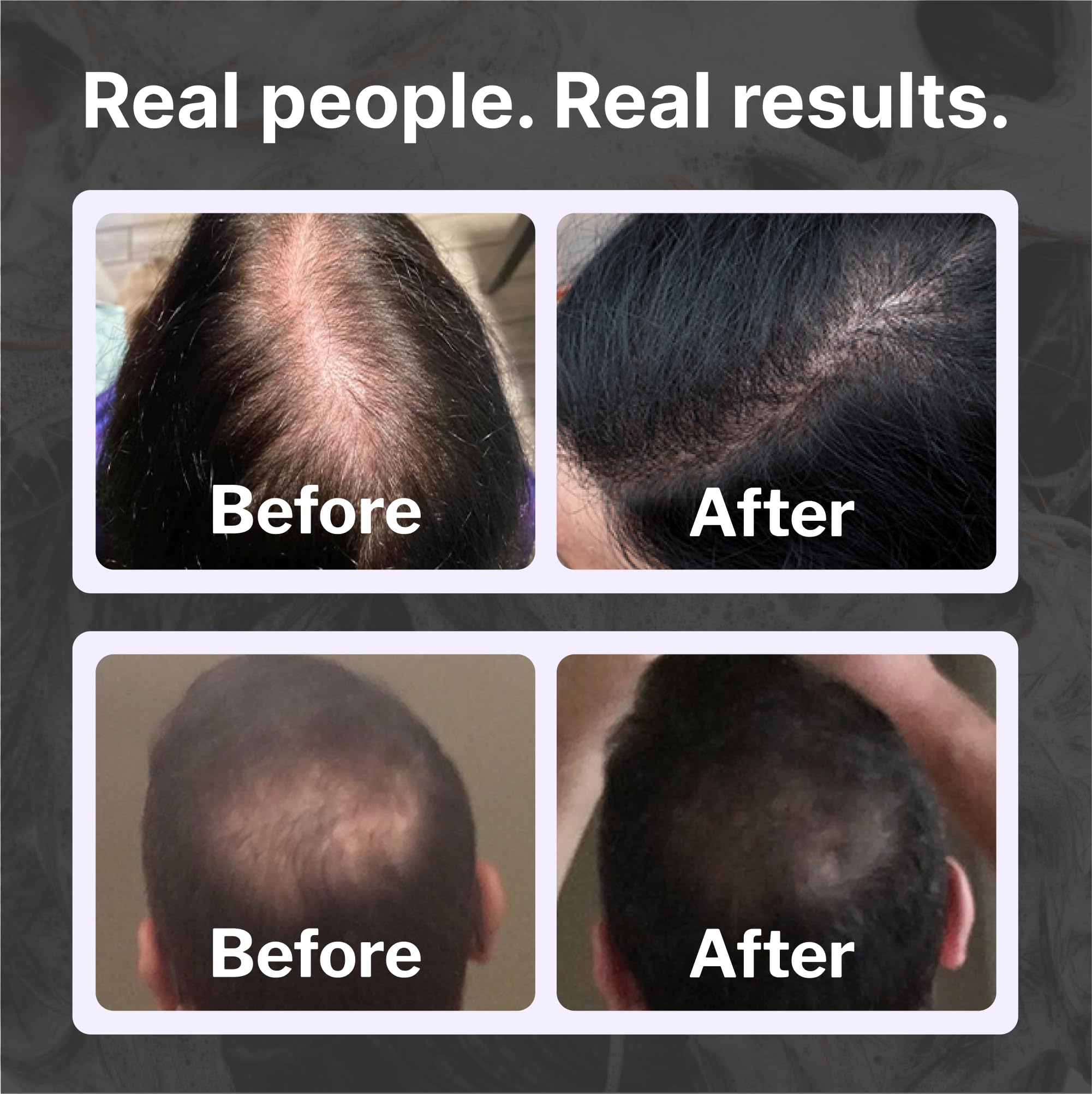Shapiro MD Natural Hair Kit ingredients show green tea and saw palmetto