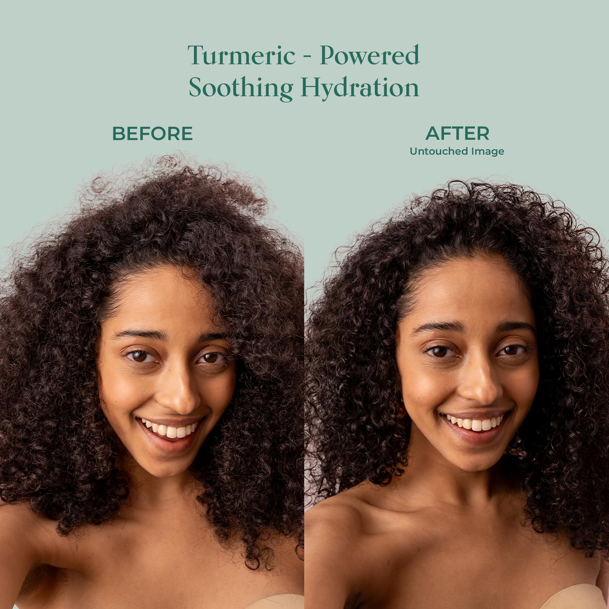 Anti-flake scalp illustration featuring SHAZ KIKS turmeric formula
