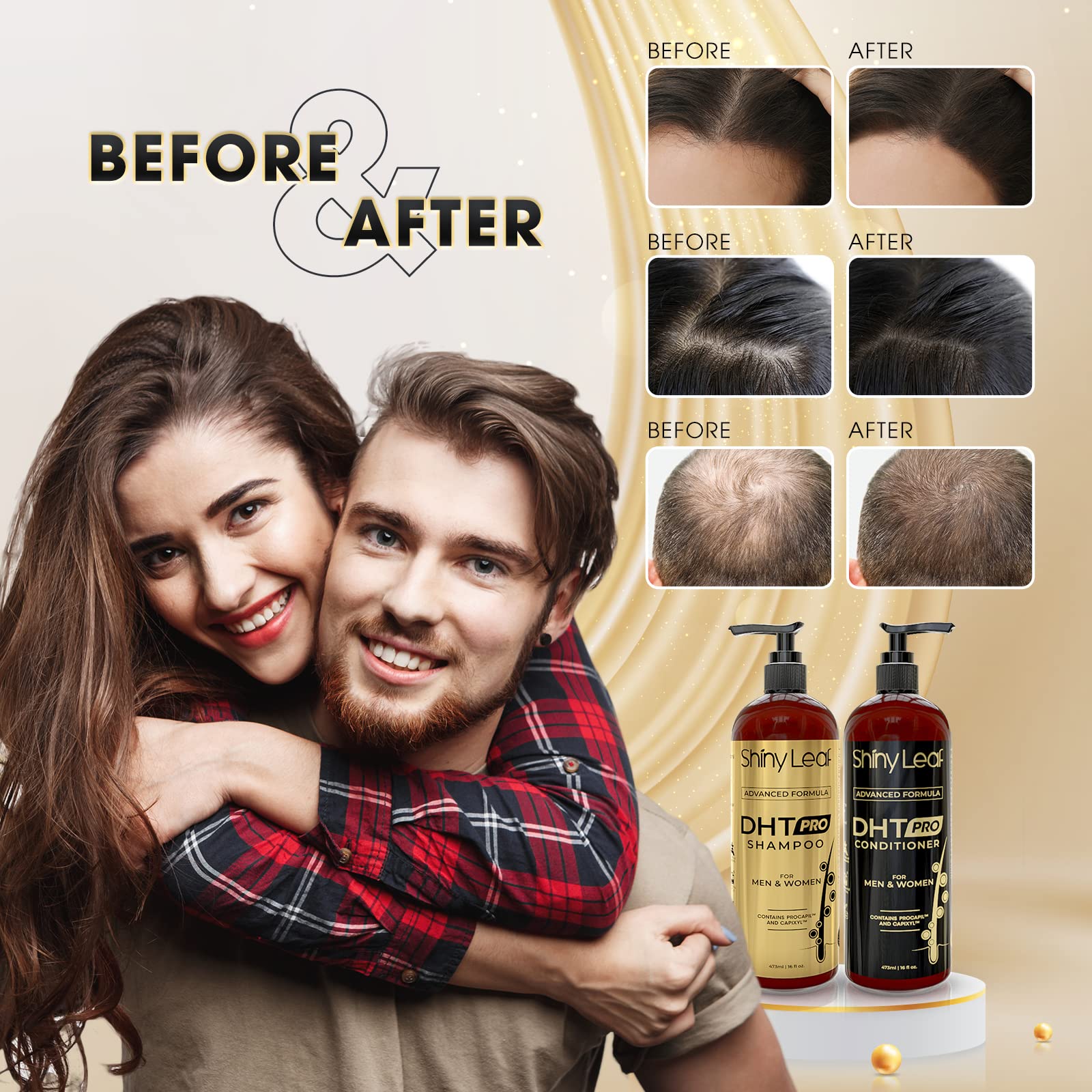 Shiny Leaf DHT Pro conditioner cream texture closeup showing moisturizing feel.