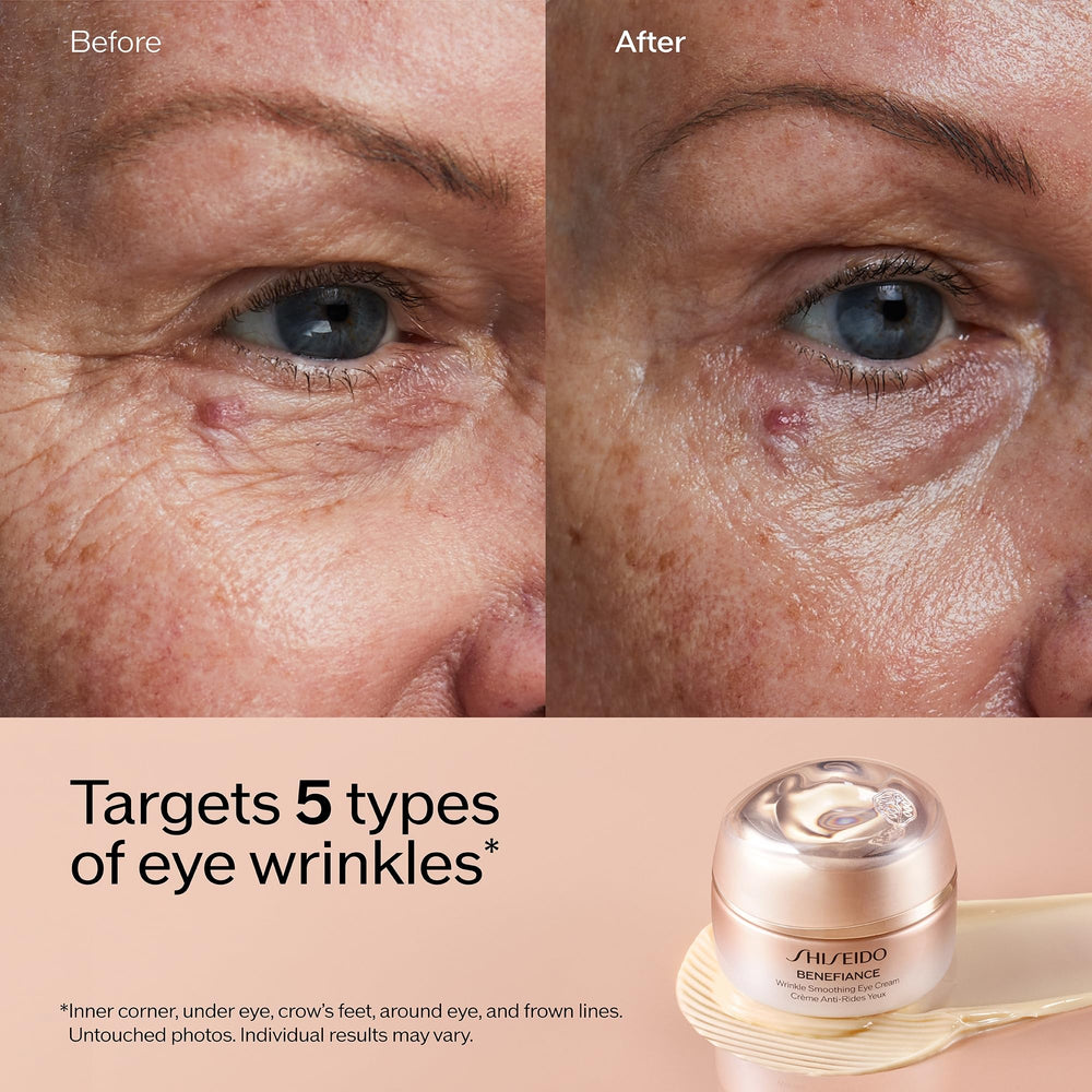 Shiseido Benefiance dark circles focus image suggesting potential brightening effect.