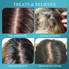 SHVYOG Scalp Scrub biotin and salicylic ingredients highlighted for scalp clarity
