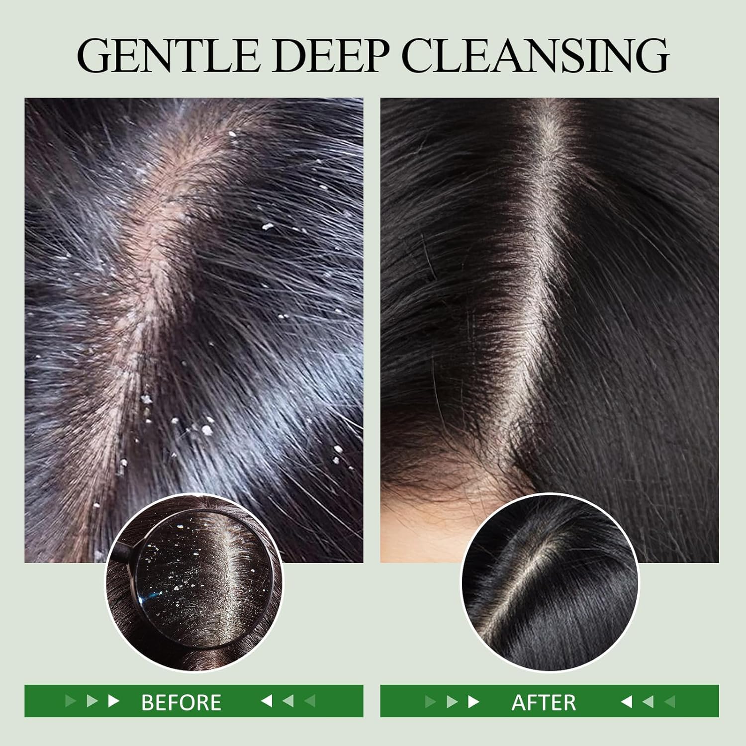 SHVYOG scalp-scrub-jojoba-oil: nourishing moisture to soothe the scalp during cleansing.